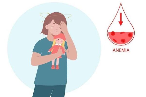 Anemia