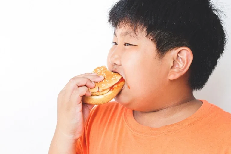 obesitas anak