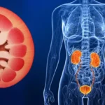 Ginjal Akut: Saat Fungsi Ginjal Tiba-Tiba Mengalami Gangguan Ginjal akut