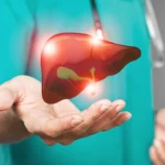 Kanker Hati: Saat Organ Penting Tubuh Mengalami Serangan Serius kanker hati