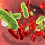 Sepsis: Saat Infeksi Mengancam Nyawa Tubuh sepsis