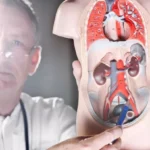 ureter kiri