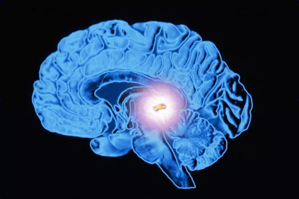 kelenjar pineal