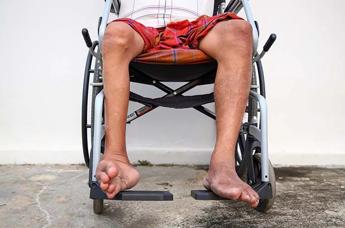 penyakit polio