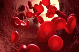 Thalassemia