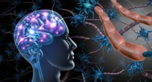 multiple sclerosis