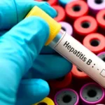 Hepatitis B