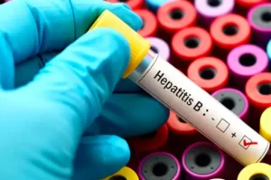 Hepatitis B