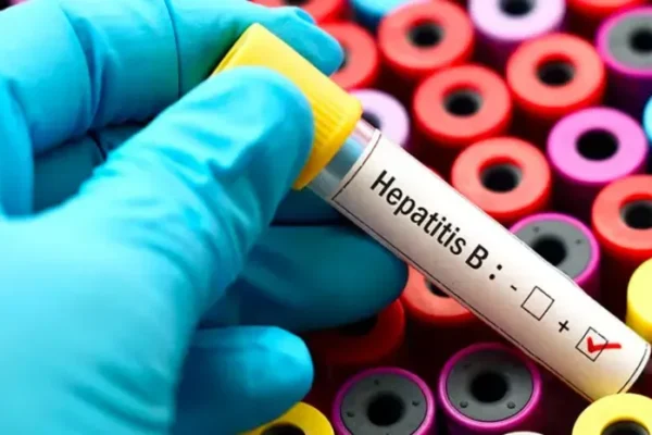 Hepatitis B