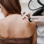 Teknologi Cryotherapy