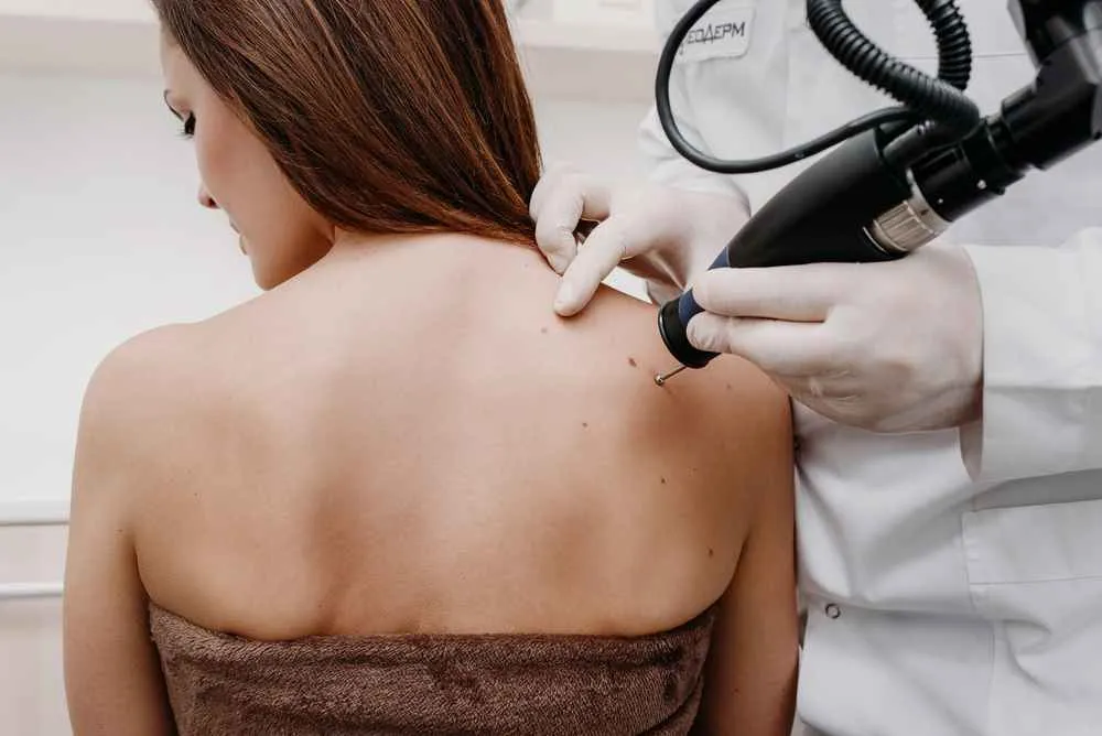 Teknologi Cryotherapy