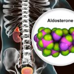 aldosteron