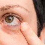 Retina