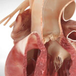 aorta manusia