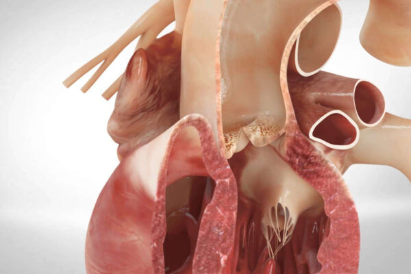aorta manusia