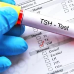 TSH