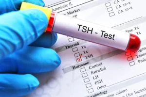 TSH