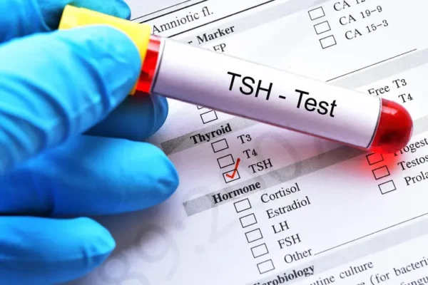 TSH