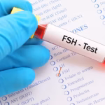 FSH