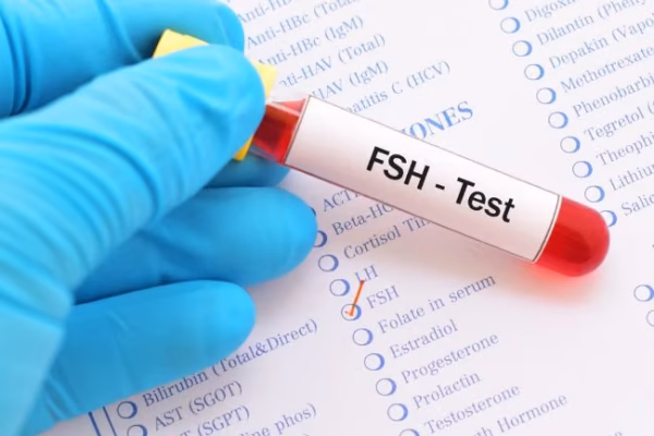 FSH